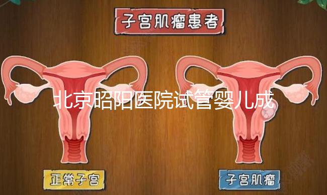 北京昭陽醫院試管嬰兒成功率？生殖醫院醫生排名推薦