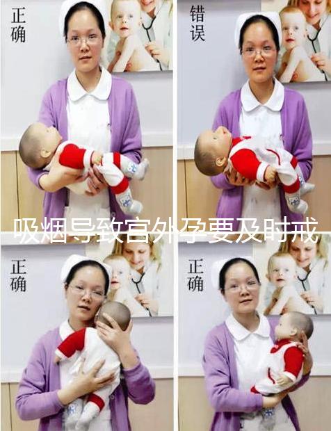 吸煙導致宮外孕要及時戒除,3種方法降低宮外孕發(fā)生率