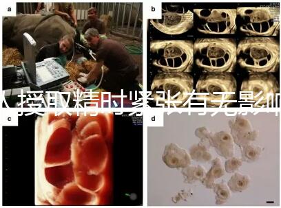 人授取精時緊張有無影響別還不造，注意事項不少不可不知