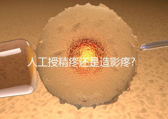 人工授精疼還是造影疼?被瞎對比，二者疼痛不是一個等級