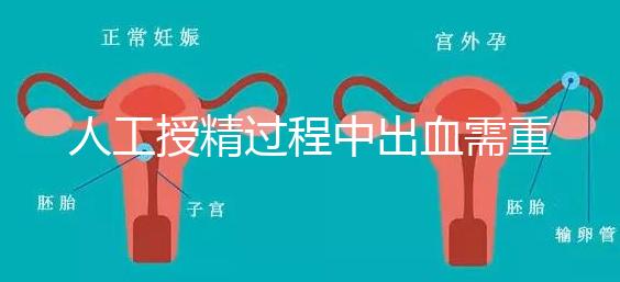 人工授精過程中出血需重視！這3種情況會影響成功率