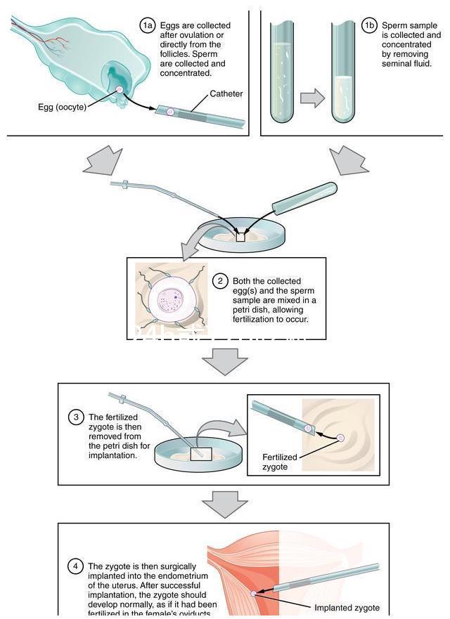 事后24h或72h吃避孕藥有效率真不高，一不小心容易中招