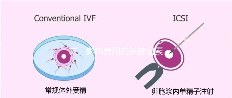 二、影響費用的關鍵因素