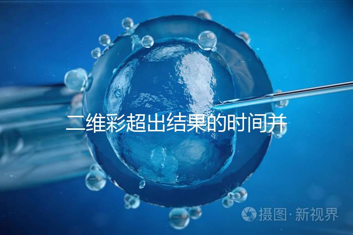 二維彩超出結果的時間并不長，從檢查流程便可看出