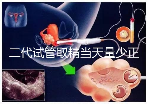 二代試管取精當天量少正不正常60s弄清，不造怎么辦速覽