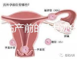 二胎臨產(chǎn)前的7大跡象，出現(xiàn)見(jiàn)紅、陣痛別大意