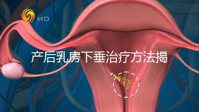 產(chǎn)后乳房下垂治療方法揭秘，按摩手法再好也沒(méi)提前預(yù)防有用