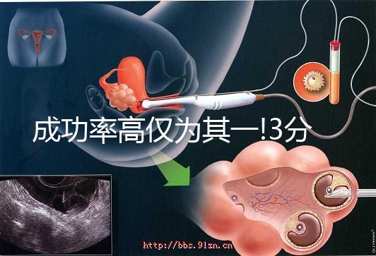 成功率高僅為其一!3分鐘看懂俄羅斯試管嬰兒的4大優(yōu)勢(shì)