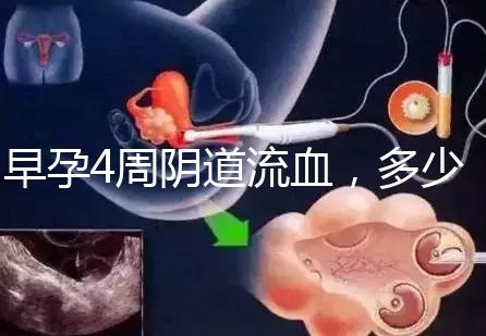 早孕4周陰道流血，多少天檢查血hcg或B超更穩妥？