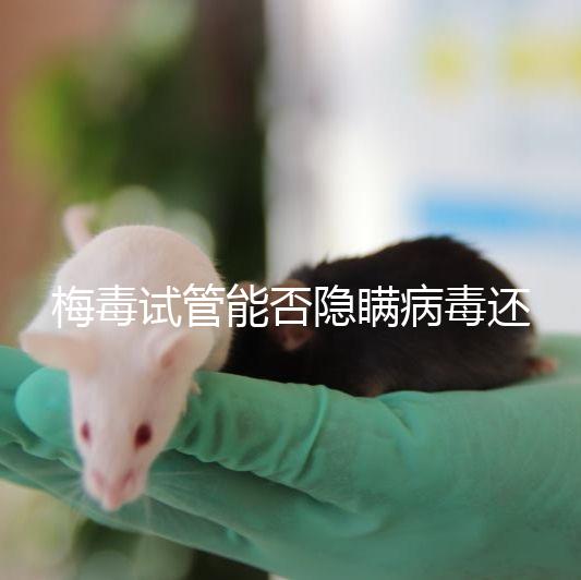 梅毒試管能否隱瞞病毒還沒有建造，備案記錄已經通知