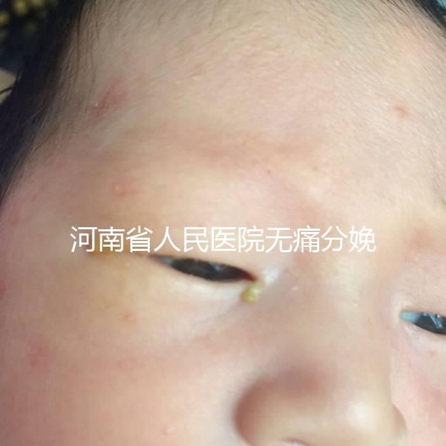 河南省人民醫(yī)院無痛分娩多少錢戳，收費(fèi)標(biāo)準(zhǔn)60s看懂不踩坑