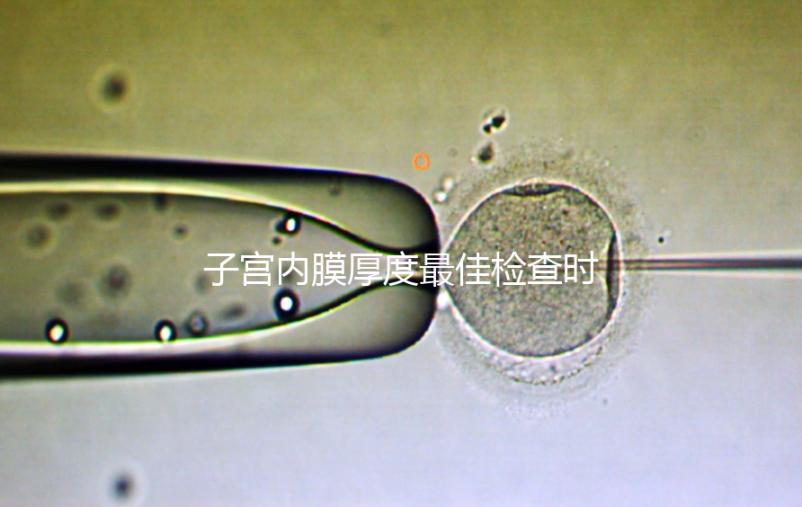 子宮內膜厚度最佳檢查時期，你有必要提前知道！