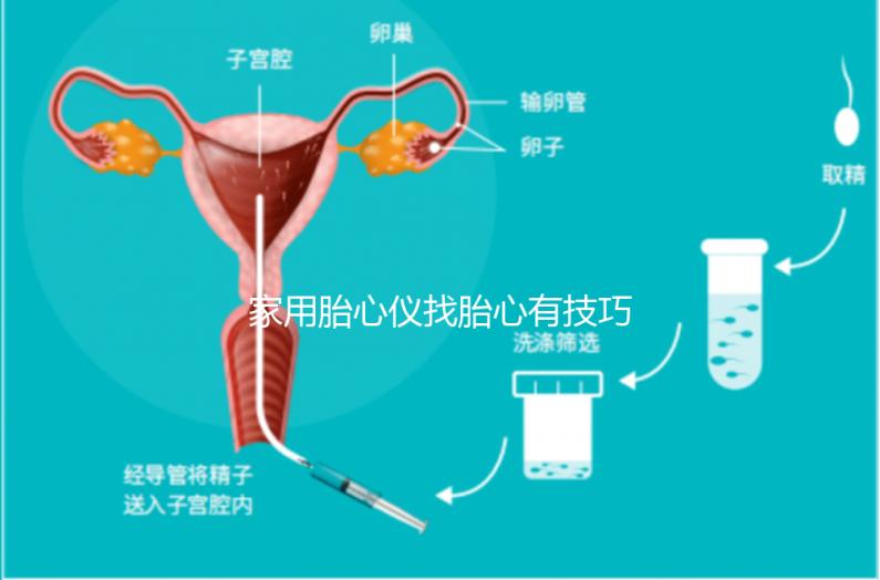 家用胎心儀找胎心有技巧，飯后半個(gè)小時(shí)測準(zhǔn)確率稍高