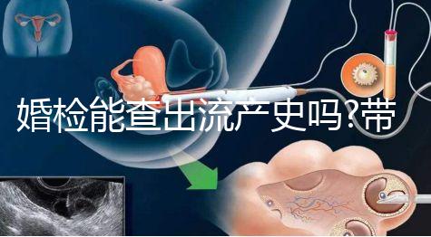 婚檢能查出流產史嗎?帶你詳細解答相關疑惑