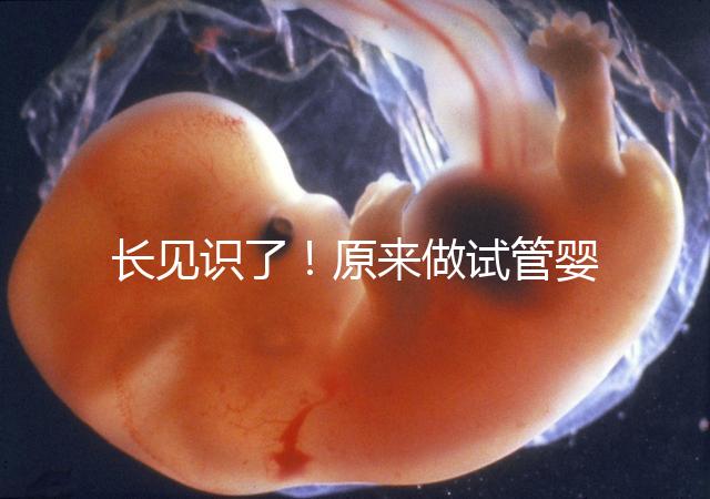 長見識了！原來做試管嬰兒，精子是這樣被篩選出來的