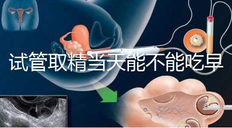 試管取精當(dāng)天能不能吃早餐喝水的答案來(lái)咯咯,好不好一看就知道了?