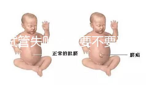 試管失敗離婚要不要退彩禮揭秘，三金怎么處理？