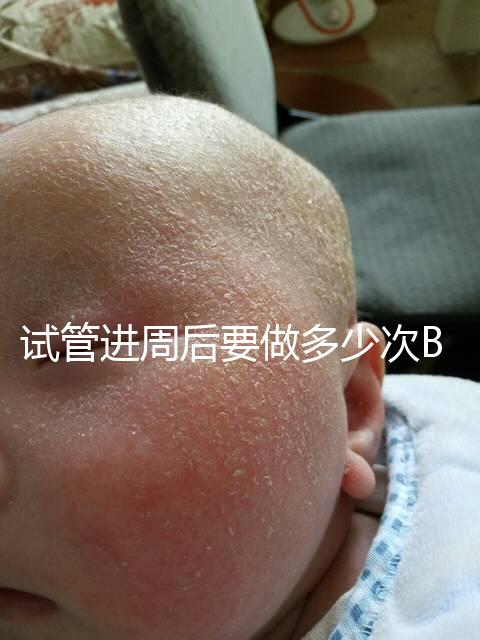 試管進(jìn)周后要做多少次B超？需要檢查什么？進(jìn)來看看