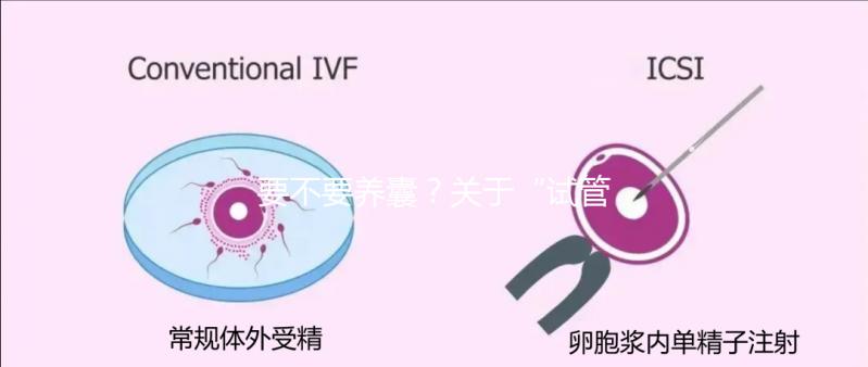 要不要養(yǎng)囊?關(guān)于“試管養(yǎng)囊”你是否會(huì)有很多問(wèn)號(hào)?