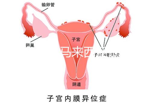 還在糾結馬來西亞試管嬰兒醫院怎么選擇?讀完這篇文章,不困難