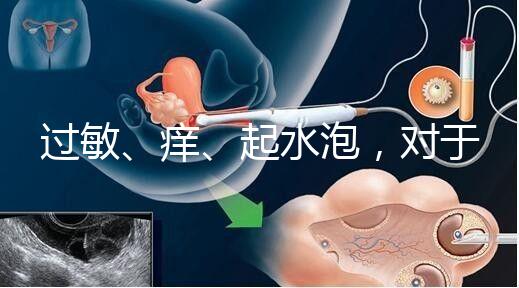 過敏、癢、起水泡，對(duì)于三伏貼的副作用你需知道該怎么辦