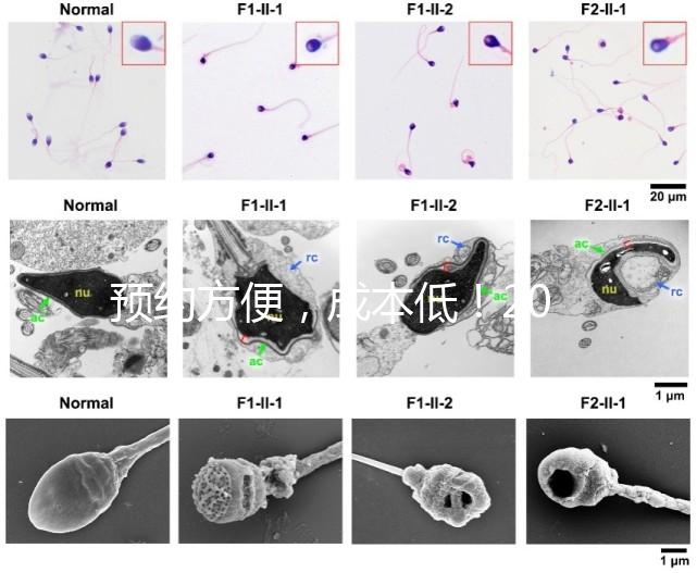 預(yù)約方便，成本低！2024年西安新城、臨潼、雁塔四維彩超指南