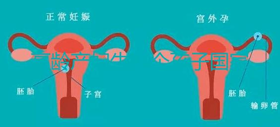 高齡產(chǎn)婦生八個(gè)孩子國(guó)家有補(bǔ)助?有沒(méi)有違法才是關(guān)鍵