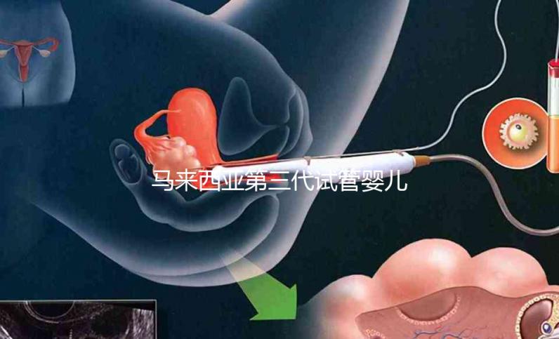 馬來(lái)西亞第三代試管嬰兒成功率真不差,一次成功真的很簡(jiǎn)單