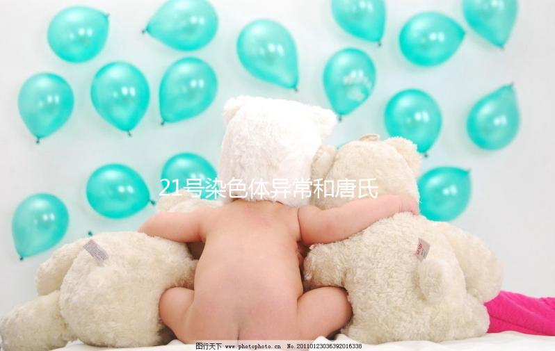 21號染色體異常和唐氏綜合癥關(guān)系不小,你肯定知道